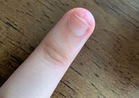 スカルプネイルで自爪を伸ばすには現在深爪気味になっており スカルプネイルをし Yahoo 知恵袋