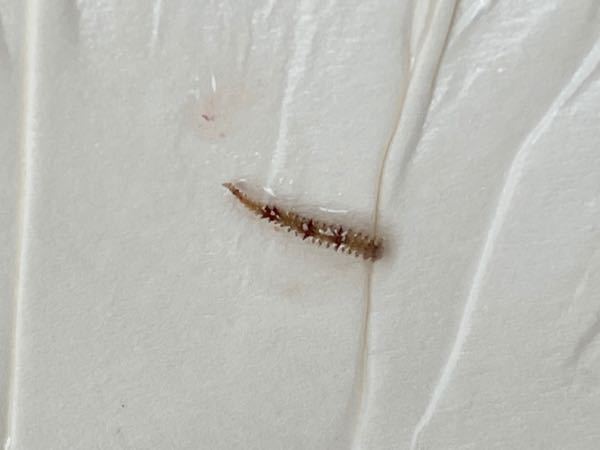 食中毒について 今日生サザエを食べたのですが 写真のような寄生虫 Yahoo 知恵袋