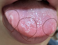 至急回答お願いします お見苦しい画像すみません３日前くらいから Yahoo 知恵袋