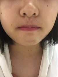 顔の片側にだけほくろが多いのはなぜでしょうか 代女子 Yahoo 知恵袋