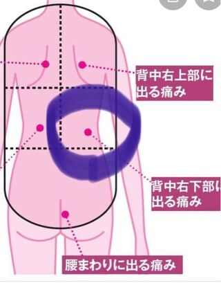 右上 背中 痛い
