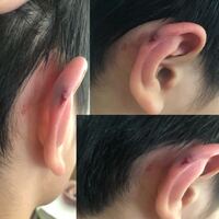 乏しい 塊 開示する 耳 あざ 突然 異なる 外部 骨