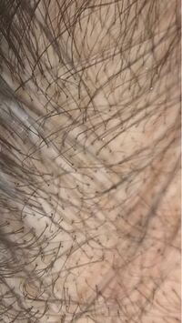 頭をかくと爪に黒いものがつきますこれは何でしょうか ちゃんと頭洗ってるつも Yahoo 知恵袋