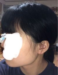 頭の形についてです この頭は はちはりですか それとも絶壁ですか 自分 Yahoo Beauty
