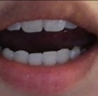 白い歯に憧れて 3dクレストホワイトニング歯磨き粉と一緒にホワイトニ Yahoo 知恵袋