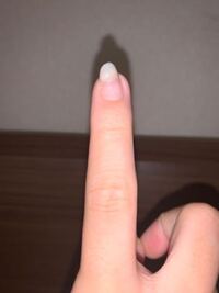 小さい頃に爪を噛んでいて以来爪の向きがおかしくなってしまいました 現 Yahoo 知恵袋