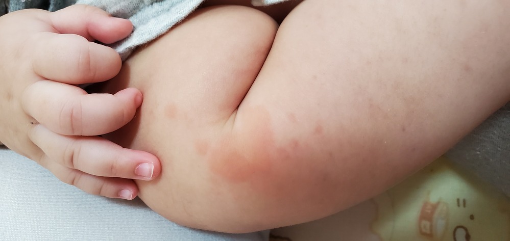 生後四ヶ月の赤ちゃんなんですが 抱っこ紐を使用して予防接種に行き 帰 Yahoo 知恵袋