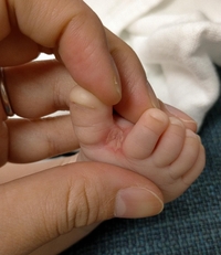 生後約2ヶ月の赤ちゃんの足の指の間が 赤く画像の様になっています 水虫でしょう Yahoo 知恵袋