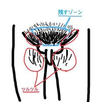 男です 家庭用のレーザー脱毛器でvioを脱毛しようと思っていて Vラインは台形 Yahoo 知恵袋
