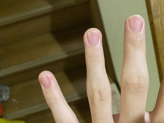 爪のピンクの部分を大きくする方法はありますか 昔爪噛み癖があって 4 Yahoo 知恵袋