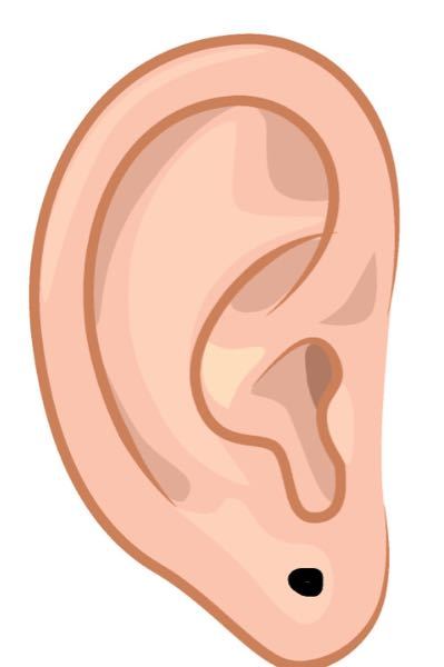 生まれつき耳瘻孔がちょうどピアスを開けるところにあります 黒い点のところです Yahoo 知恵袋