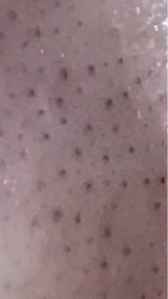 閲覧注意 鼻の毛穴の黒ずみがなくなる方法はありませんか 毛穴に効く Yahoo 知恵袋