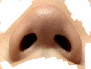ほじる 大きく なる 鼻
