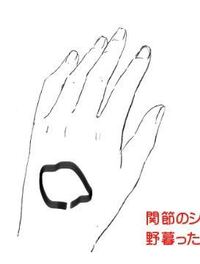 過食嘔吐の人に質問します 指吐きしてると歯が当たってここら辺に Yahoo 知恵袋