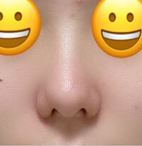 正面から見て 鼻の穴が少し見えるのですが これは豚鼻というやつでしょうか Yahoo 知恵袋