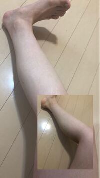 エステやダイエット 詳しい方に質問です お見苦しい写真で申し訳ないの Yahoo 知恵袋