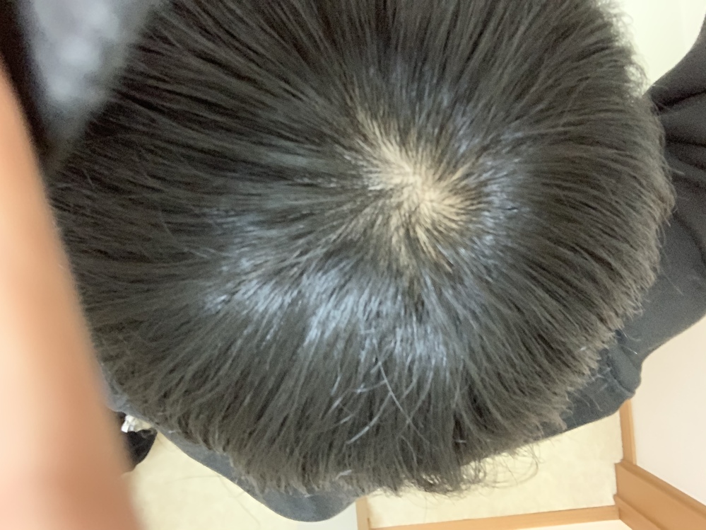 髪を切ったばかりなんですがこれってつむじハゲですか Yahoo 知恵袋