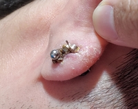 ピアス開けて2ヶ月程です キャッチの裏に黒い塊がずっとくっつ Yahoo 知恵袋