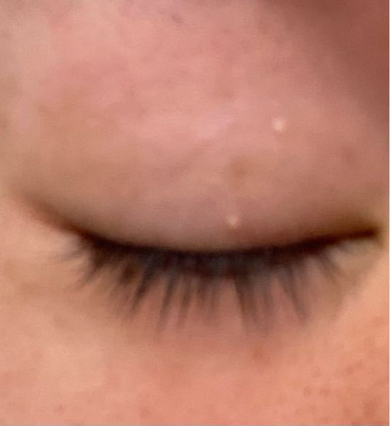 目の上に白い点のようなものがずっとあります これはなんですか Yahoo 知恵袋