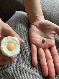 至急お願いします 今 卵を割ったら写真のような 白いかたまりが出ました これ Yahoo 知恵袋