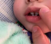 9ヶ月です 上の歯と下の歯がぶつかって いつもこんな感じです Yahoo 知恵袋