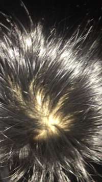 高校1年です最近抜け毛が多く シャンプーの時に手に結構付くほど抜けます これは Yahoo 知恵袋