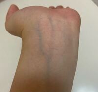 パーソナルカラー診断で血管の色が緑or青どちらかという選択が出てきた Yahoo 知恵袋