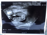 赤ちゃんの性別判断をしていただきたいです エコー画像は22wです 病院で Yahoo 知恵袋