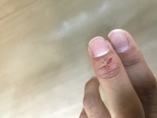 なる 絆創膏 白く