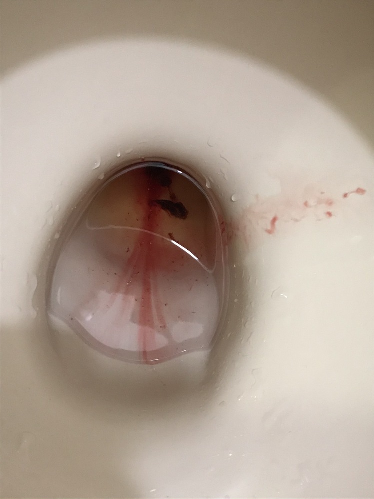妊娠6週ちょっとです トイレに行き 拭いたら血が付いていて驚きました Yahoo 知恵袋
