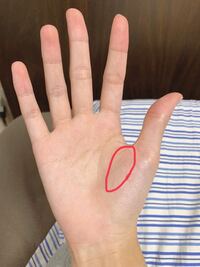 テニスをしてから写真の丸してる所が痛むのですが 筋肉痛ですか 強く握り続 Yahoo 知恵袋