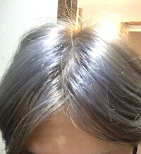 ヘアカラーをしたら一部分だけ画像のように青くなってしまいました どう Yahoo 知恵袋