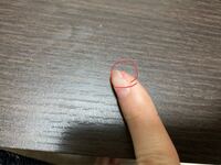 先日包丁で爪をスライスするように切ってしまいました 元は 爪が張り付いて Yahoo 知恵袋