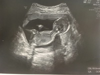 初産 妊娠5ヶ月の妊婦です 16週に検診があり 性別が分かるかドキド Yahoo 知恵袋