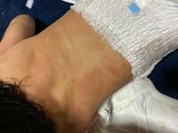 ベビーダノンについて 知恵袋でよく見るのですが ベビーダノンってヨーグルトじ Yahoo 知恵袋