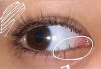 逆さまつげについて こんにちは 見てくださってありがとうございま Yahoo 知恵袋