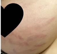 産後1ヶ月です 妊娠4ヶ月くらいから出来たのですが これは妊娠 Yahoo 知恵袋