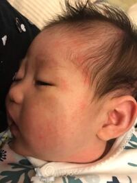 赤ちゃんにあげるヨーグルト ９ヶ月の赤ちゃんがいます 離乳食でヨーグル Yahoo 知恵袋