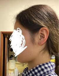 横から見た時に輪郭がはっきりしないのが悩みなのですが これは骨格のせいですか Yahoo 知恵袋
