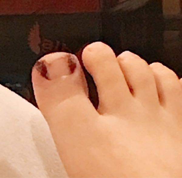 急募閲覧注意 中学1年女子です今度友達とお泊まり会をすることになったのです Yahoo 知恵袋