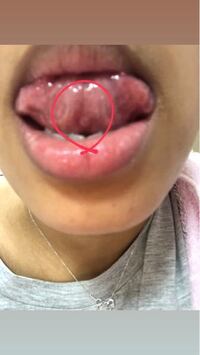 なんでこんなに舌白いんですか 心配ですし 気になったので質問いたし Yahoo 知恵袋