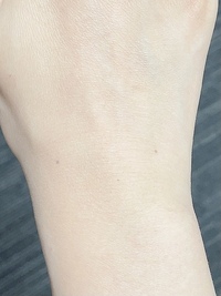写真のように手首にホクロがあります このほくろの意味はいいことがあり Yahoo 知恵袋
