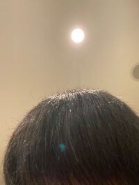 シャンプーしてトリートメントしてヘアオイルしてドライヤーした後なので Yahoo 知恵袋