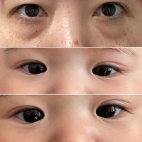 赤ちゃんに涙袋がない 画像有り コイン500枚 生後11ヶ月の女の子な Yahoo 知恵袋