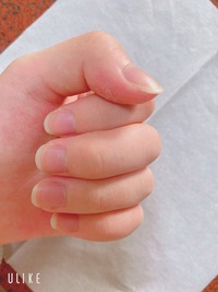 この手は綺麗だと思いますか 爪の形が短いのがなんか嫌です 長くする方 Yahoo 知恵袋