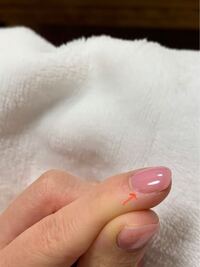 ソラストの医療事務でジェルネイルは大丈夫でしょうか ワンカラーの目 Yahoo 知恵袋