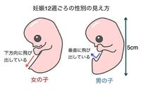 今３人目妊娠中で１１wです 上2人男の子で３人目は女の子希望ではあるので Yahoo 知恵袋