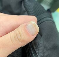 爪のcカーブがきついですかなりつよいカーブなので先細りして とき Yahoo 知恵袋