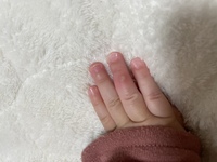 1歳の娘の中指が化膿してしまいました。
どうしたらいいのか教えてください。 明日とか小児科受診した方がいいものなのか…絆創膏とか包帯を巻いた方がいいのか…
などなど対処法教えてください。

p.s
絶賛指しゃぶり中で化膿した中指と人差し指です。予防接種で3/5に小児科受診予定です。
