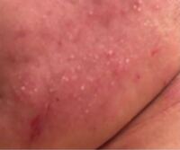 この顔にできる白いプツプツはなんですか わかる人がいたら教えて Yahoo 知恵袋